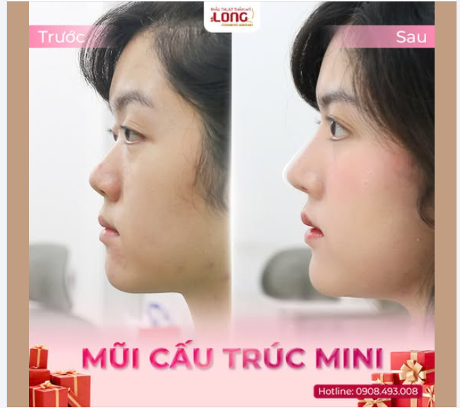 Ringker ringker….Có phải người ghé không?  Cô nàng thư giãn đón giáng sinh có gì khác biệt?