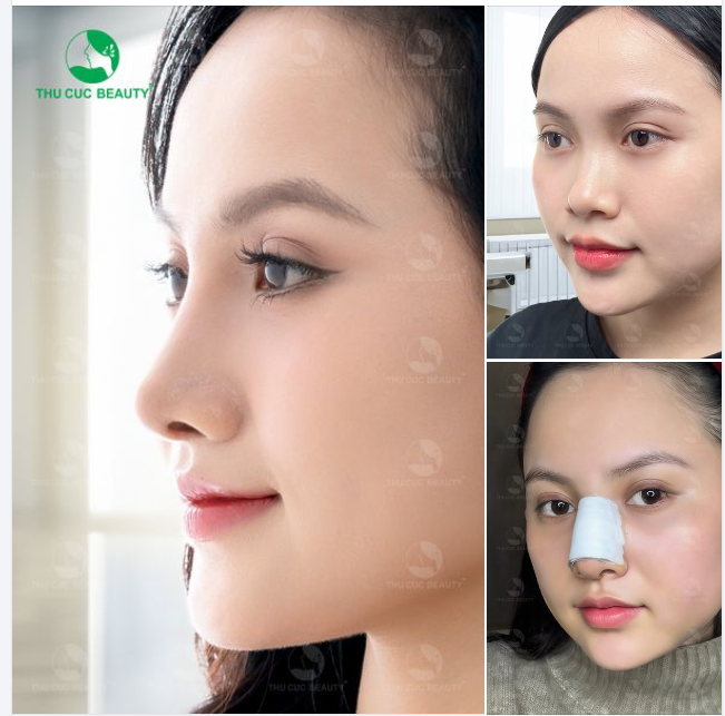 Đến TC Sở hữu dáng mũi cao sang, thần thái tự tin