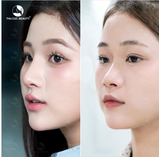 Chỉ 1 chi tiết phá hỏng khuôn mặt Kiểm chứng ngay qua post dưới đây