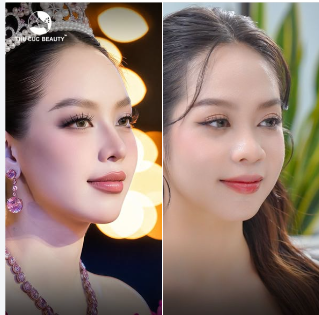 Bạn có nhân ra sự khác biệt giữa hai bức ảnh này