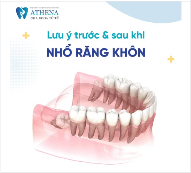 Những lưu ý trước và sau khi nhổ răng khôn