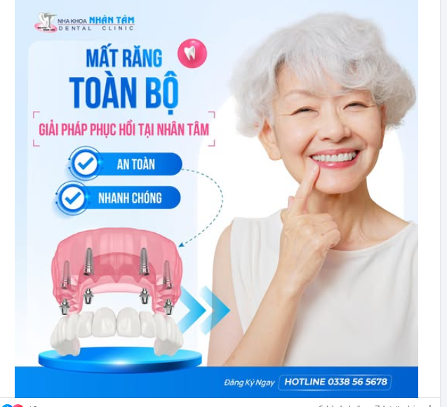 Mất răng toàn bộ - Giải pháp phục hồi nhanh chóng hiệu quả tại Nha khoa Nhân Tâm