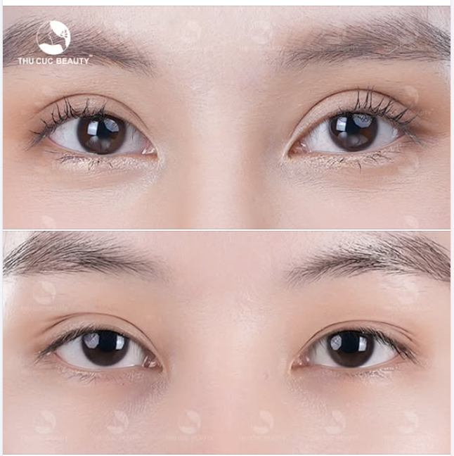  KH Nhật Linh feedback hình ảnh 2 mí nét xinh