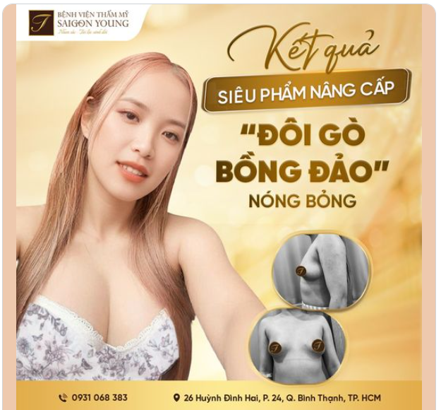“SIÊU PHẨM” NÂNG CẤP VÒNG 1 - NGẮM LÀ MÊ