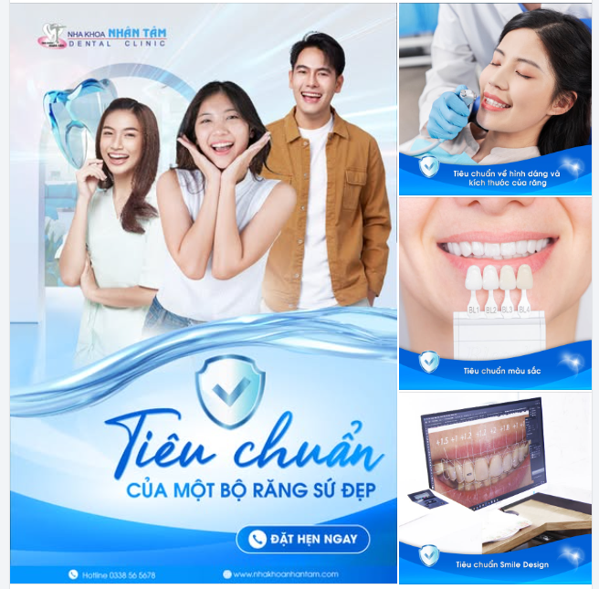 Tiêu chuẩn của một bộ răng sứ đẹp?