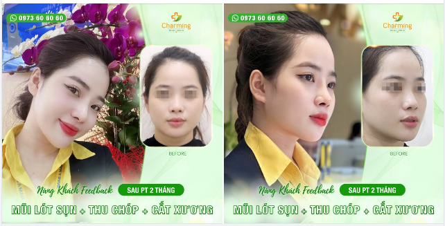 Gặp gỡ nàng khách hàng xinh đẹp đã lựa chọn TMV Charming để thực hiện hành trình "nâng tầm nhan sắc".