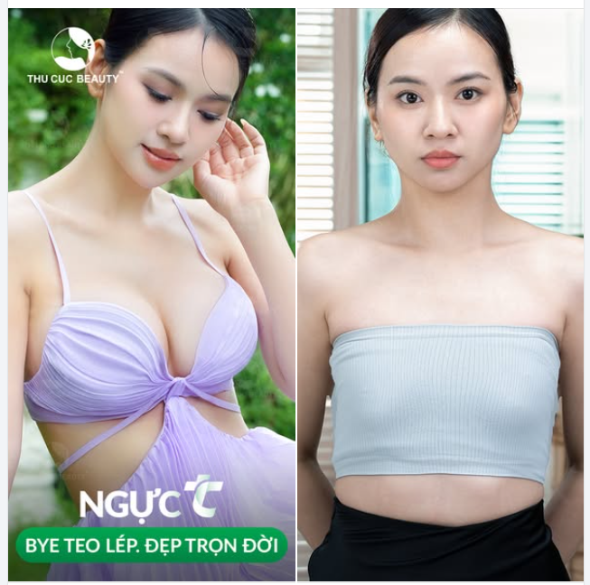  Chiêm ngưỡng ngay V1 của Hoa khôi Dương Thùy hậu nâng ngực