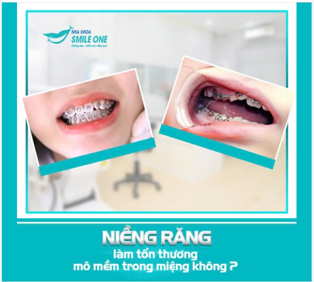 KHÔNG NHA SĨ NÀO SẼ NÓI CHO BẠN NHỮNG ĐIỀU NÀY!