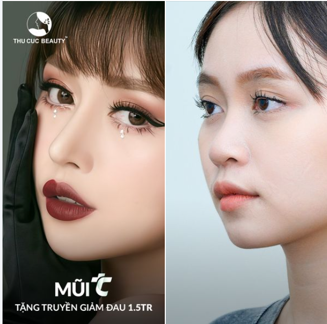 Nâng mũi ngay bây giờ để đón tết