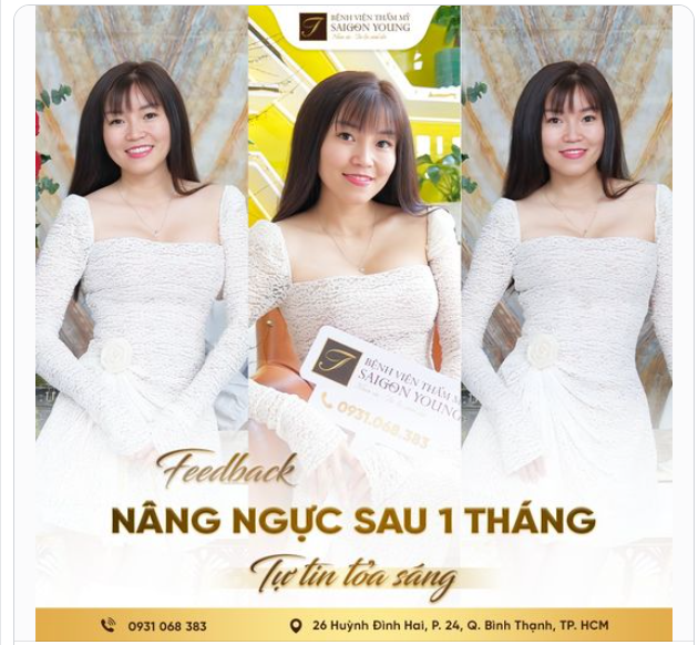 Không hở hang, không táo bạo. Đơn giản mà tinh tế, quyến rũ lại sâu lắng, đó chính là vẻ đẹp của khách hàng dưới ống kính của Saigon Young khi đến tái khám sau 1 tháng nâng ngực.