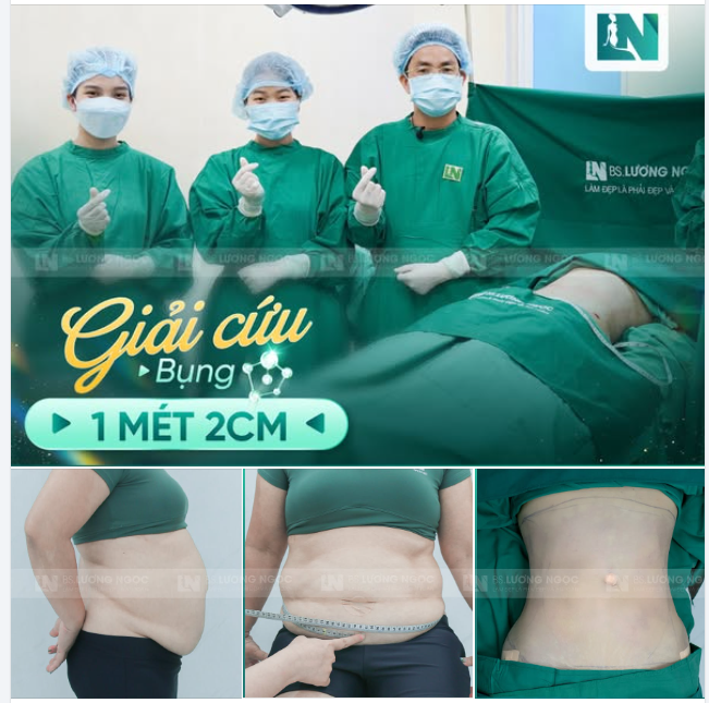 GIẢI CỨU THÀNH CÔNG BỤNG 102CM