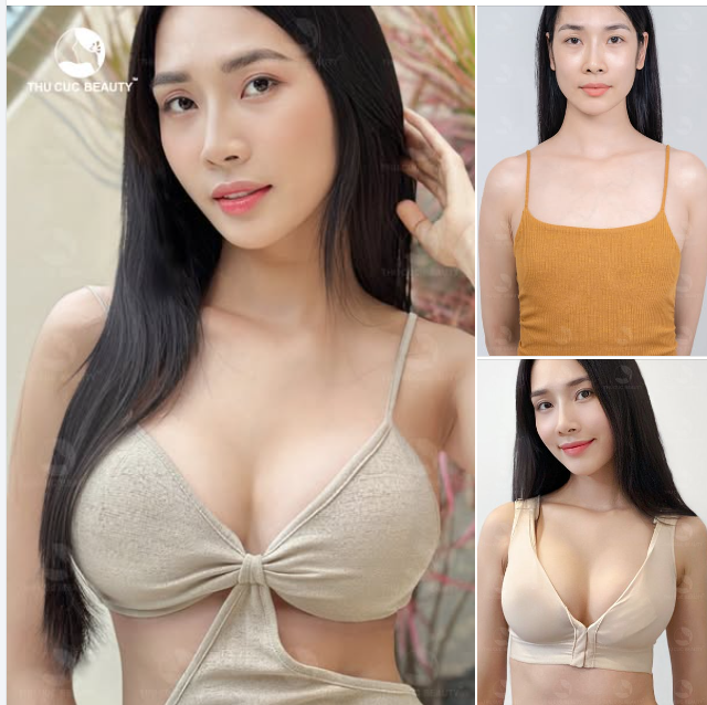 Ngực TC 39.9Tr Chia tay V1 teo lép   Upsize V1 căng tròn, gợi cảm đầy thu hút