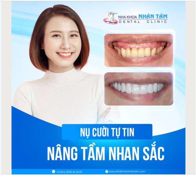 NỤ CƯỜI TỰ TIN NÂNG TẦM NHAN SẮC