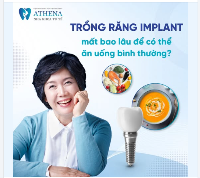 Trồng răng Implant mất bao lâu để ăn bình thường