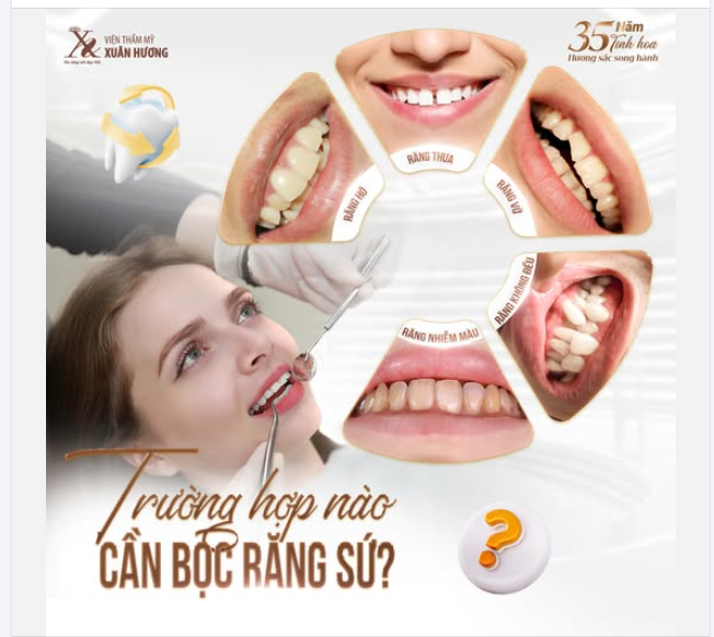 Trường hợp nào cần bọc răng sứ?