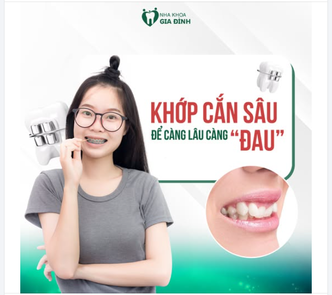 KHỚP CẮN SÂU - CÀNG ĐỂ LÂU CÀNG "ĐAU"