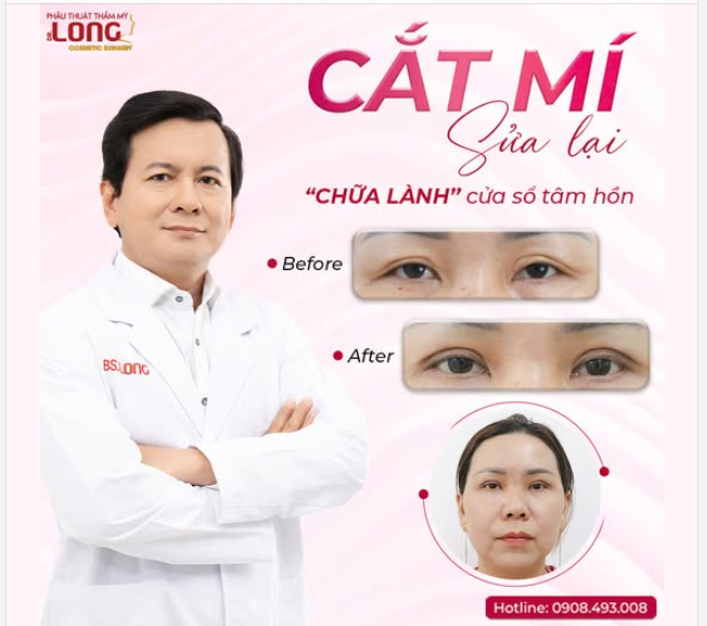 CẮT MÍ SỬA LẠI “CHỮA LÀNH” CỬA SỔ TÂM HỒN