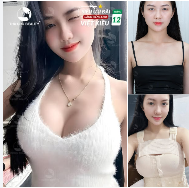 Siêu ưu đãi dành riêng cho Kiều Bào khi nâng ngực tại TC