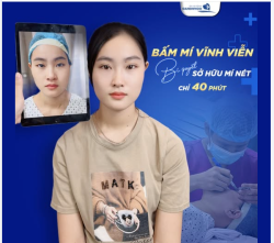 BẤM MÍ VĨNH VIỄN - BÍ QUYẾT SỞ HỮU MÍ NÉT CHỈ VỚI 40 PHÚT