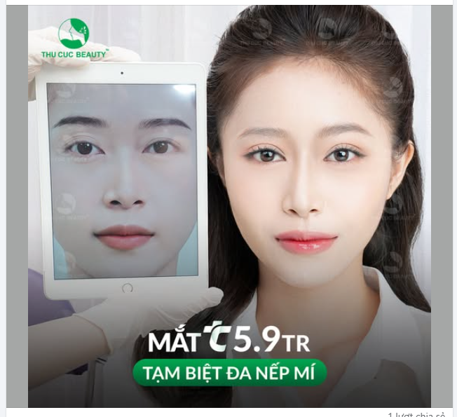 Bạn trở nên xinh đẹp quyến rũ hơn khi tạm biệt đôi mắt đa nếp mí