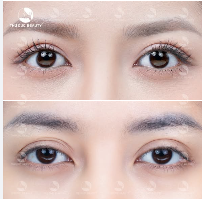 Hết mắt lờ đờ gương mặt tươi sáng trong trẻo