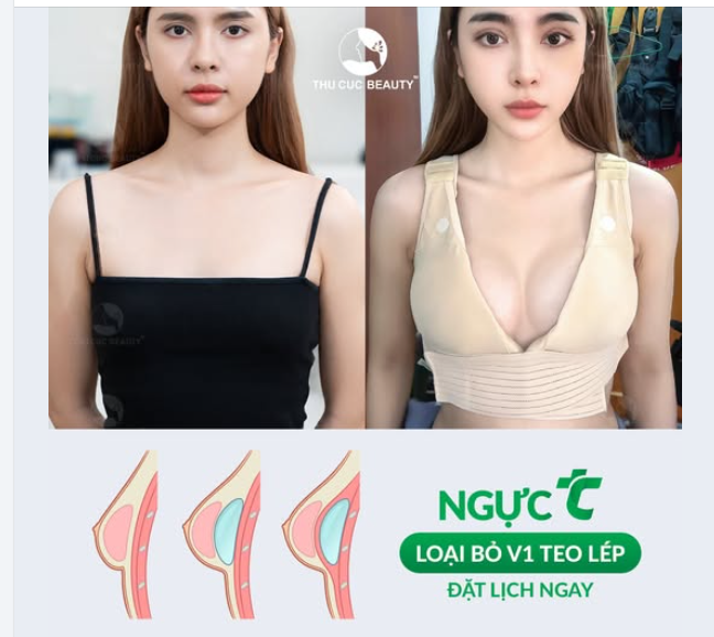 Giải cứu Vòng 1 teo lép khiêm tốn cho bạn gái