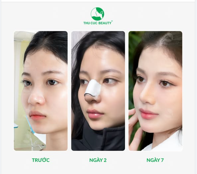 Khuôn mặt trở nên thanh thoát hơn Chỉ cần thay đổi 1 chi tiết