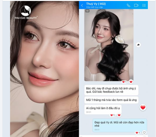 Nâng mũi Không đau. Sinh hoạt bình thường sau PT