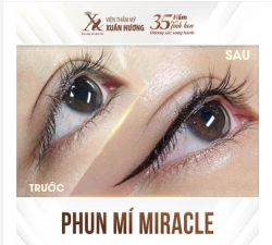 PHUN MÍ MIRACLE - BÍ QUYẾT CHO NHỮNG ĐÔI MẮT ẤN TƯỢNG!