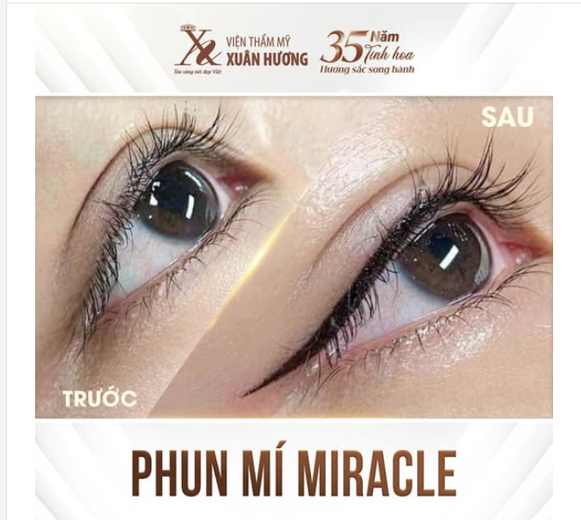 PHUN MÍ MIRACLE - BÍ QUYẾT CHO NHỮNG ĐÔI MẮT ẤN TƯỢNG!
