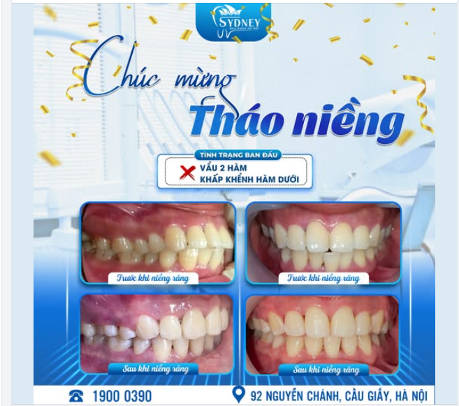 CHÚC MỪNG THÁO NIỀNG KH. VŨ THẮNG