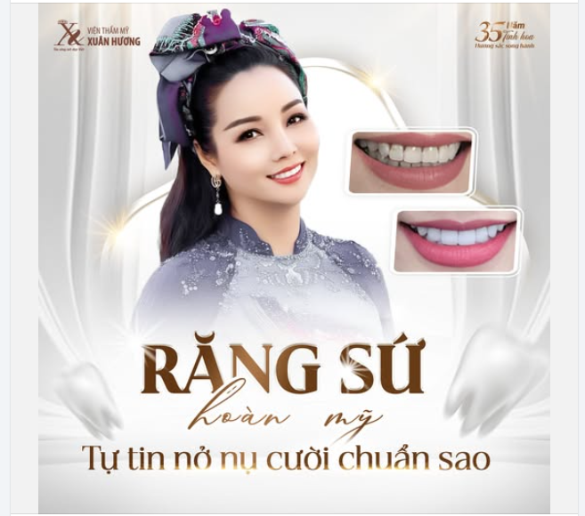 Răng sứ hoàn mỹ - Tự tin nở nụ cười chuẩn !