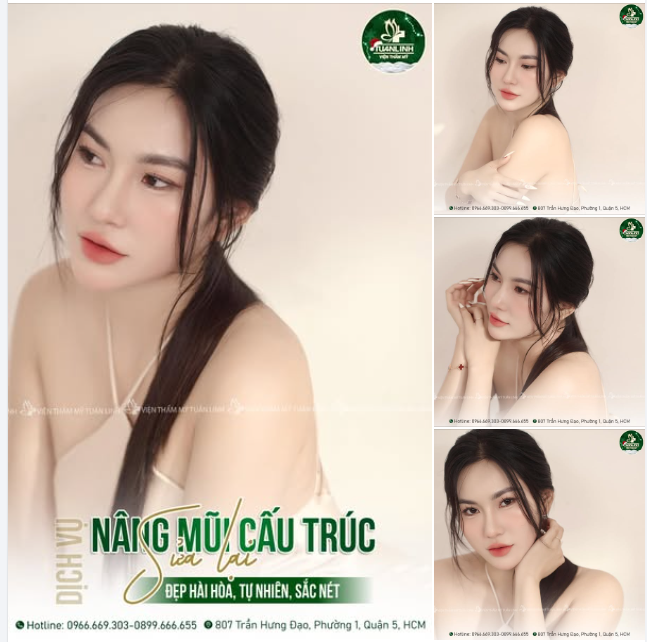 Mũi sửa lại - Đẹp hài hòa, tự nhiên mà vẫn sắc nét!!