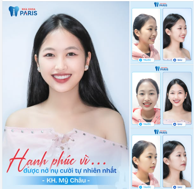 AI CŨNG XỨNG ĐÁNG SỞ HỮU NỤ CƯỜI HOÀN HẢO!