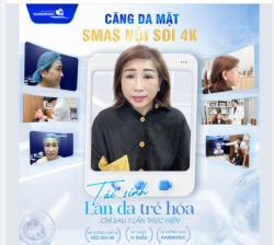 CĂNG DA MẶT SMAS NỘI SOI 4K TÁI SINH LÀN DA TRẺ SAU 1 LẦN THỰC HIỆN