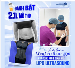 TRẢ LẠI VÒNG EO THON GỌN NHỜ CÔNG NGHỆ GIẢM MỠ LIPO ULTRASOUND