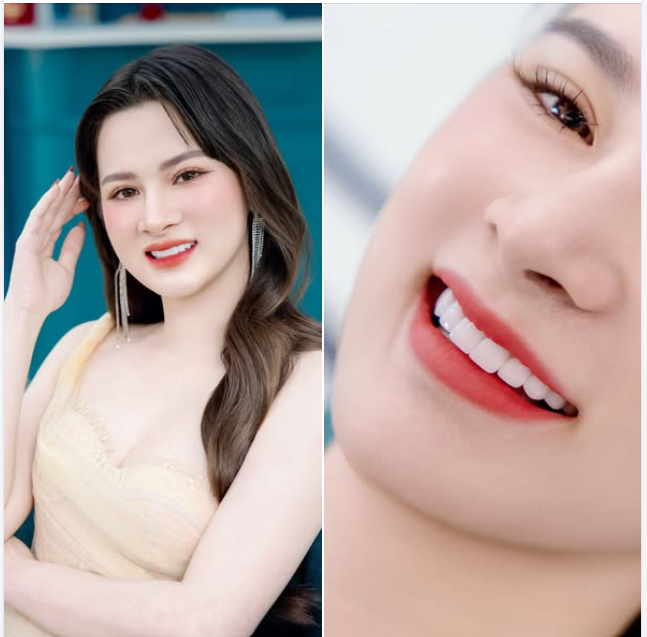 Đầu năm vừa rồi mình quyết định làm bộ răng sứ mà giờ ngẫm lại vẫn thấy quyết định quá sáng suốt.