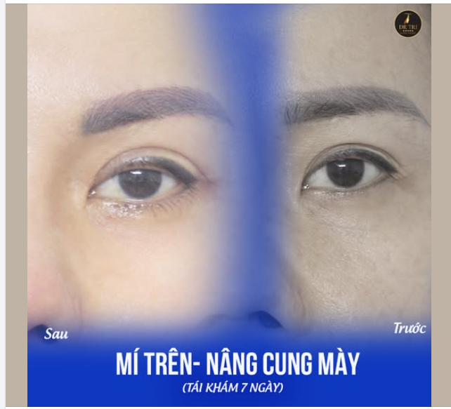 Có mí ưng ý sau 7 ngày