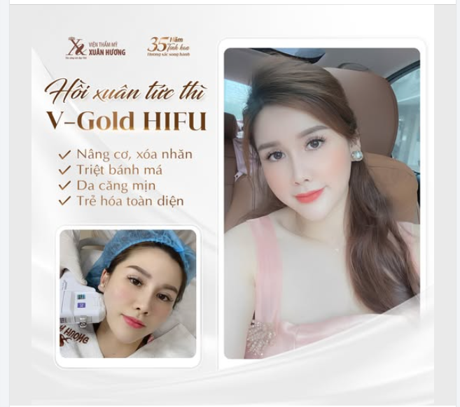 “Từ ngày thực hiện xong dịch vụ nâng cơ VGold Hifu. Ai cũng khen mình trẻ hơn so với tuổi thật. Nhiều người còn thốt lên sao chị trẻ thế.”