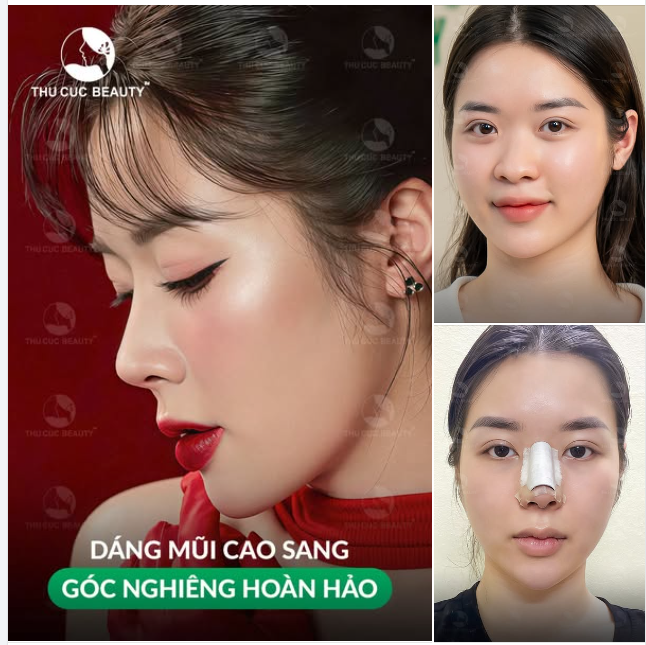 Chia tay chiếc mũi tẹt kém sang đón mũi cao, góc nghiêng thần thánh