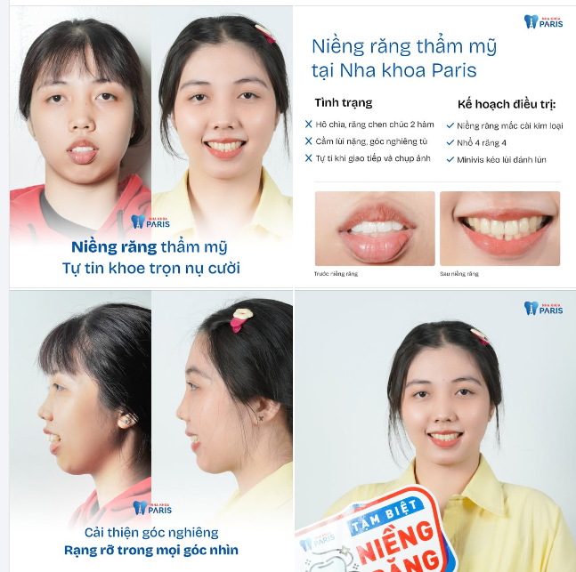 THÁO NIỀNG XONG LÀ PHẢI SĨ LÊN NÀO CÁC ĐỒNG NIỀNG ƠI!