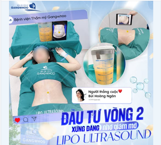 ĐẦU TƯ VÒNG 2 XỨNG ĐÁNG NHỜ GIẢM MỠ LIPO ULTRASOUND