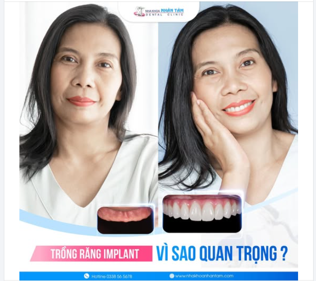 54 tuổi có phải là độ tuổi khiến chúng ta ngừng việc thay đổi bản thân? Chị N.Đ.M đến từ Kiên Giang đã chứng minh điều hoàn toàn ngược lại.