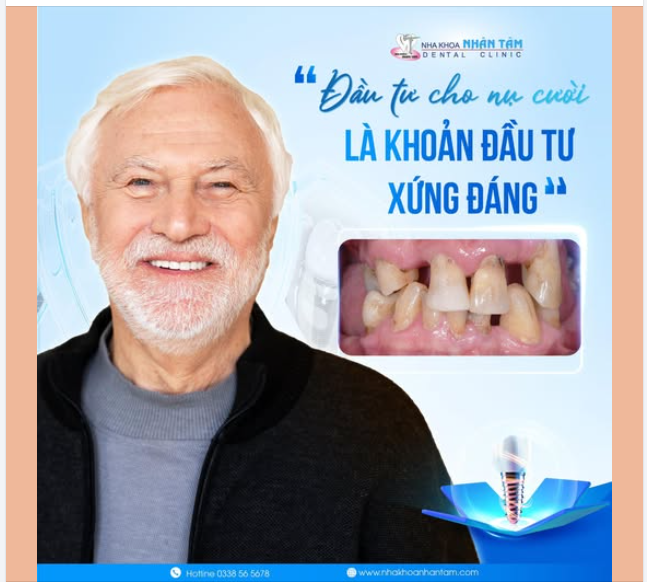 “ĐẦU TƯ CHO NỤ CƯỜI LÀ KHOẢN ĐẦU TƯ XỨNG ĐÁNG”