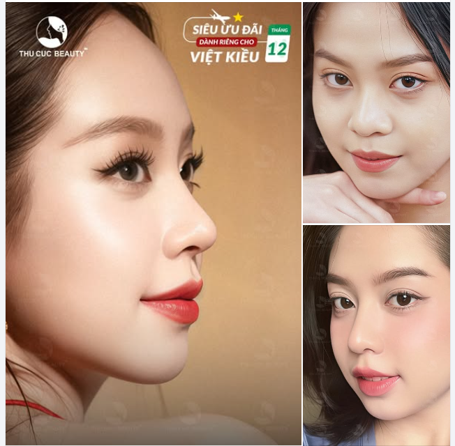 Đến TC Có ngay dáng mũi cao thon, chuẩn tỷ lệ như Hoa hậu Quốc tế Thanh Thuỷ