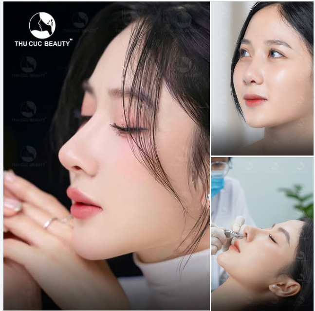 Nâng Mũi TC 11.9Tr Mũi thấp tẹt được cải thiện sau 30P 