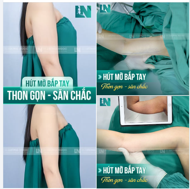 BẮP TAY THON BÉ XÍU