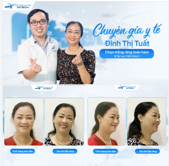 CHUYÊN GIA Y TẾ ĐINH THỊ TUẤT: " THẬT SÁNG SUỐT KHI TRỒNG RĂNG TẠI LẠC VIỆT INTECH"