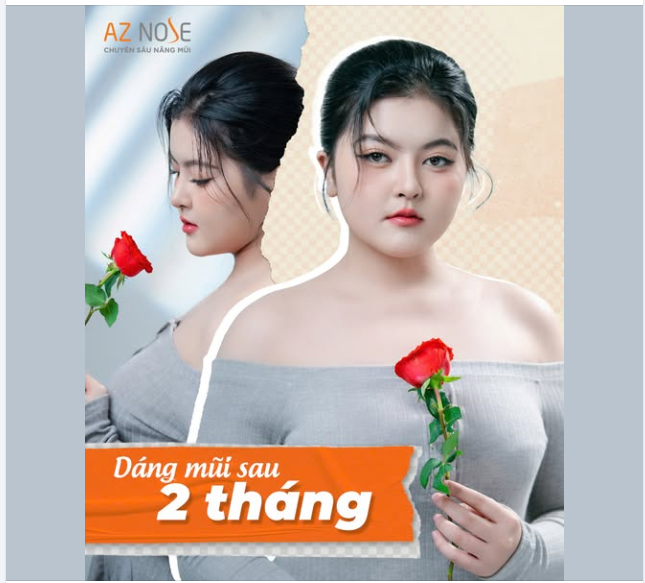Co-founder shop thời trang đến từ Kiên Giang sau 2 tháng nâng mũi