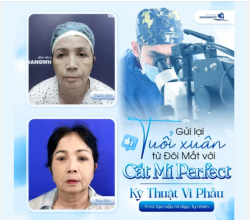 GỬI LẠI TUỔI XUÂN TỪ ĐÔI MẮT VỚI CĂT MÍ PERFECT